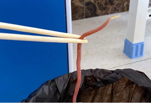 患者竟然口吐蛔虫   医生为患者打虫并嘱咐注意手卫生及饮食卫生