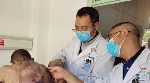 红河州肿瘤医院成功切除“骆驼大叔”背负15年罕见巨大神经纤维瘤