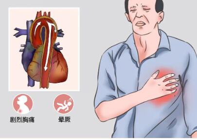 “就像耗子咬着疼得要死” 主动脉夹层患者九死一生“捡回老命”