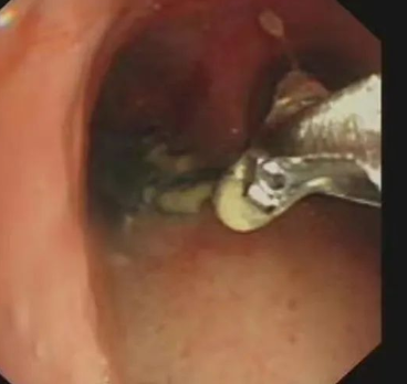 1651886276257496.png image.png